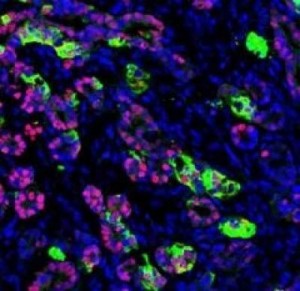 human pancreatic cells