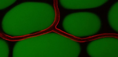 Small blood vessel capillary (red) growth can help fat-loaded cells (green) in adipose tissue to improve metabolic balance in obesity-associated type 2 diabetes.
