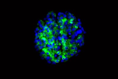 Skin Stem Cells Turned into Insulin Producing Cells