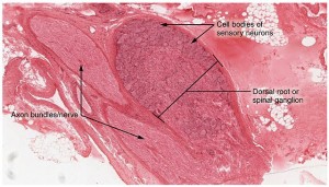 Dorsal Root Ganglion - Diabetic Neuropathy