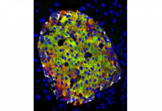 Insulin-producing cell in the islets